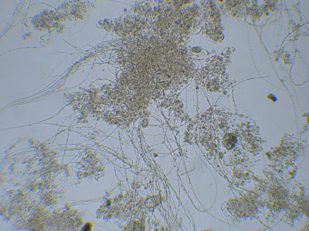 対策をせず、糸状菌が発生している汚泥（糸状菌バルキング）