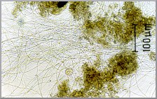 糸状性バルキング汚泥の顕微鏡写真